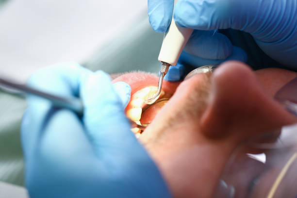 Best Urgent Care for Lost Fillings or Crowns in Grant, NE