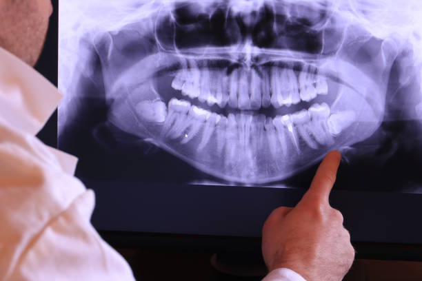 Best Pediatric Emergency Dentist in Grant, NE