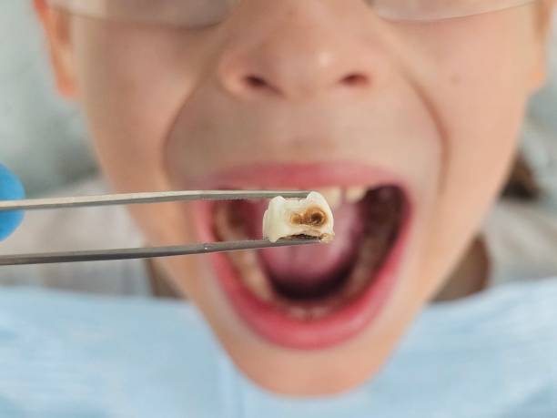 Best Emergency Gum Treatment in Grant, NE
